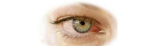 Irritación ocular 